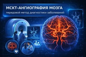 МСКТ ангиография мозга как передовой метод диагностики заболеваний