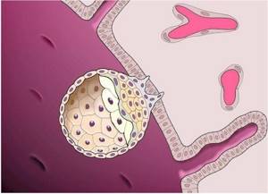 Какой должен быть эндометрий для подсадки эмбрионов при ЭКО