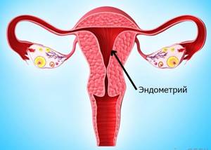 Тонкий эндометрий: причины и лечение, беременность