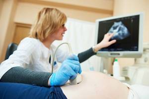 Диагностика миомы матки: УЗИ, МРТ, анализы