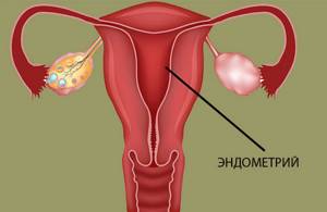 Эндометрий при менопаузе: норма толщины