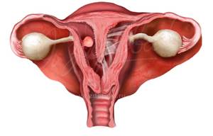 Патология эндометрия: что это такое у женщин