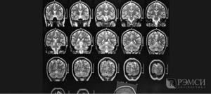 Полное обследование головного мозга: какой методике отдать предпочтение