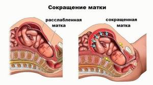 Как снять тонус матки при беременности в домашних условиях: препараты и народные средства
