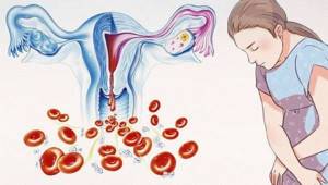 Диагностика эндометриоза: как выявить болезнь?