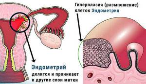 Толщина эндометрия для зачатия: норма, чтобы забеременеть