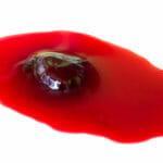 Сгустки крови при месячных: причины выхода кусков, похожих на печень