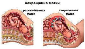 Но-шпа при тонусе матки во время беременности