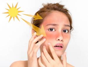 Как защитить кожу от Солнца: 21 средство от солнечных ожогов