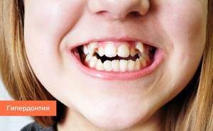 Причины возникновения заболеваний зубов и десен