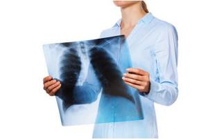 Туберкулёз - симптомы, лечение, диагностика и профилактика