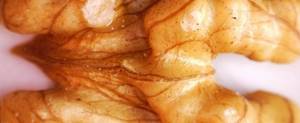 Грецкий орех - химический состав, свойства и противопоказания