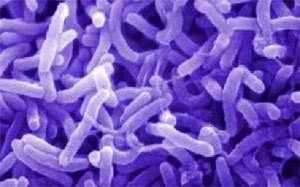 Что такое холера: Причины, симптомы, профилактика и лечение инфекции