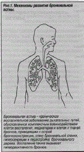 Поэтапная диагностика бронхиальной астмы