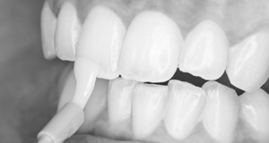 Укрепляющее средство при заболеваниях зубов