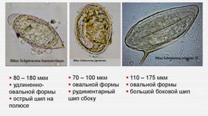 Шистосоматозы (schistosomatoses)