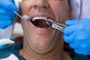 Средство для облегчения воспаления после удаления зуба