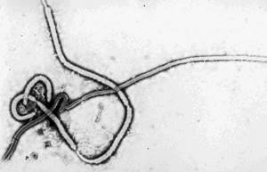 Лихорадка Эбола: причины, симптомы и лечение этой опасной болезни