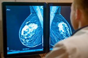 Обследование молочных желез (груди) и для чего делается маммография?