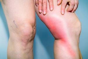 Почему болят ноги: 9 причин этого расстройства и как их устранить?
