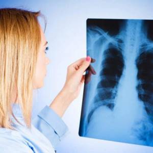 Что такое туберкулёз и как его лечить чтобы устранить признаки и причины?