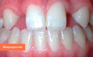 Инфекционные болезни зубов и десен: Какой риск они представляют?