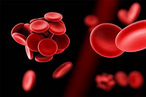 Тромбоэмболия артерий конечностей - причины, симптомы и лечение
