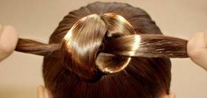 Алопеция (облысение): Что делать если выпадают волосы?