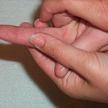 Операции по поводу заболевании пальцев кисти и стопы