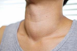 Нарушения деятельности щитовидной железы