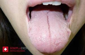 Средство для полоскания полости рта из календулы и облепихи