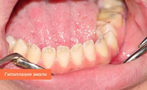 Причины возникновения заболеваний зубов и десен