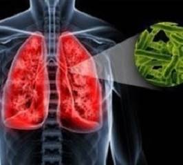 Что такое туберкулёз и как его лечить чтобы устранить признаки и причины?